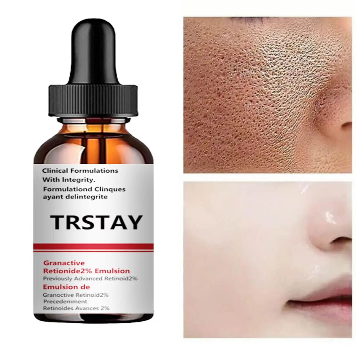 Pore Minimizer Serum For Face Facial Pore Narrowing Serum Pore Contraction Tightens Essence Shrink Pores Tight lifting Serum Peaceful Pleasures Health and Wellness