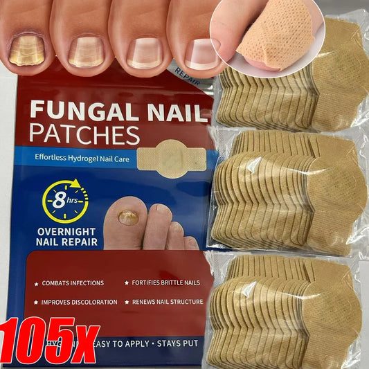 Nail Repair Patches – Toenail Care & Ingrown Correction Stickers Nail Care Patch Oasis Select