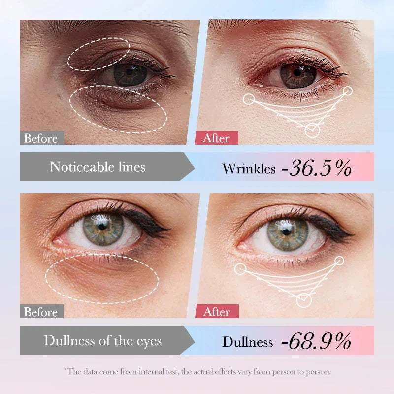 SADOER 4-in-1 Roll-On Eye Cream | Retinol, Vitamin C & Niacinamide
