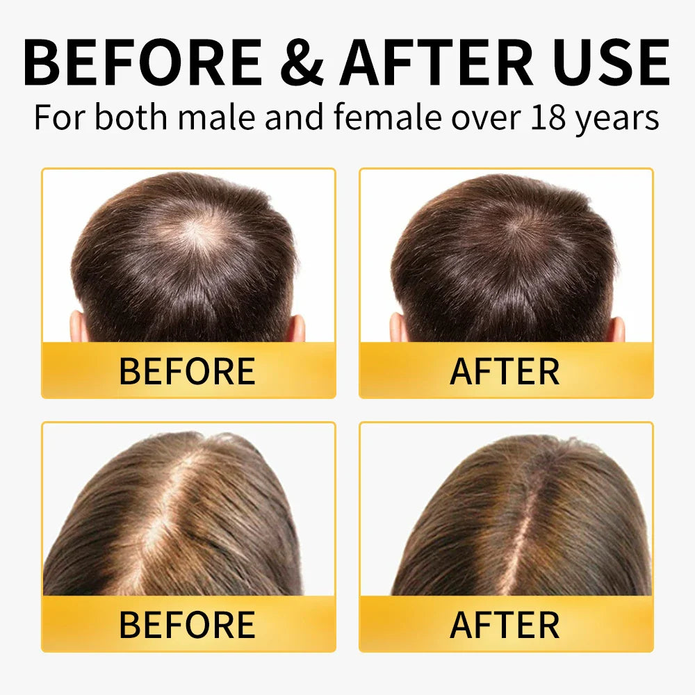 Ginger Shampoo & Conditioner Set for Thinning Hair | Men & Women