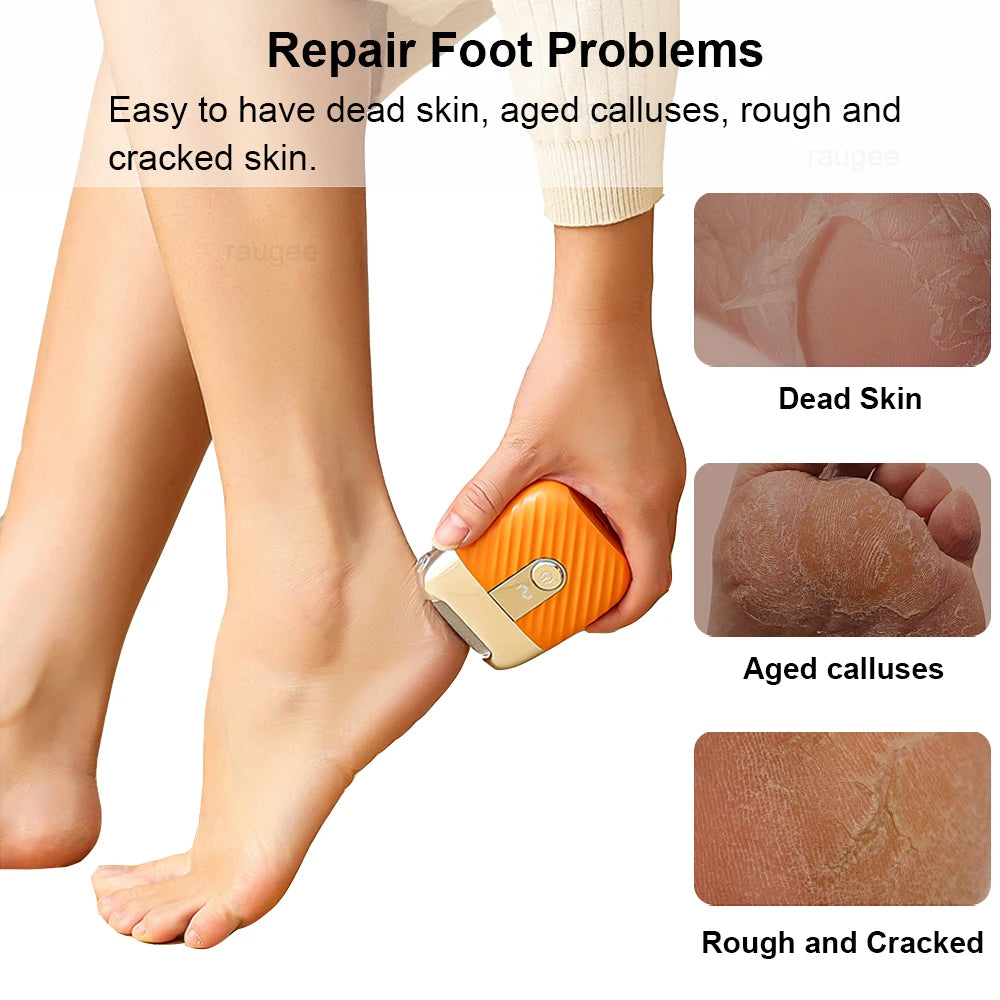 Electric Foot Grinder Portable Electric Callus Remover for Feet Foot Exfoliation Sander Rechargeable Electric Foot File Pedicure Peaceful Pleasures Health and Wellness