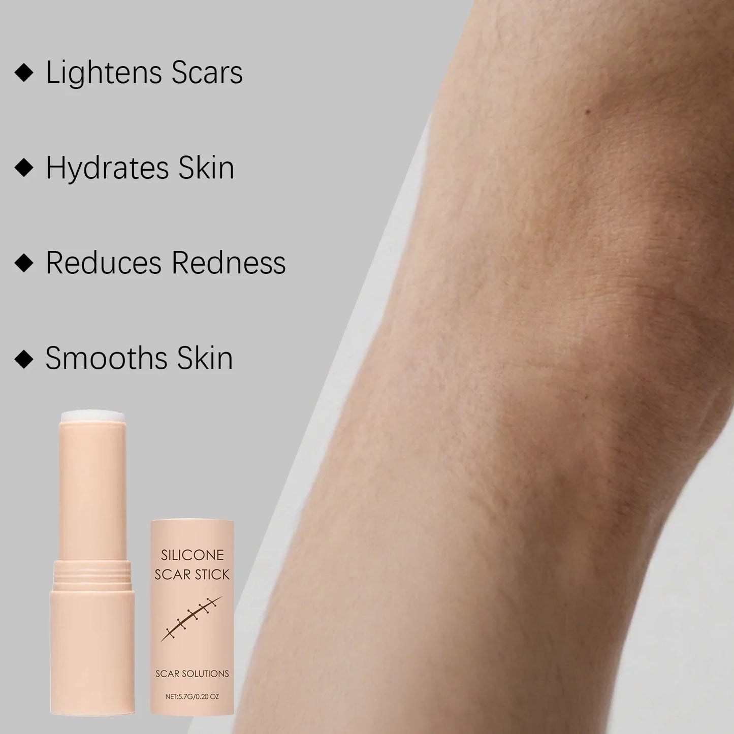 Scar Care Moisturizing Stick – Face & Body Hydrating Balm