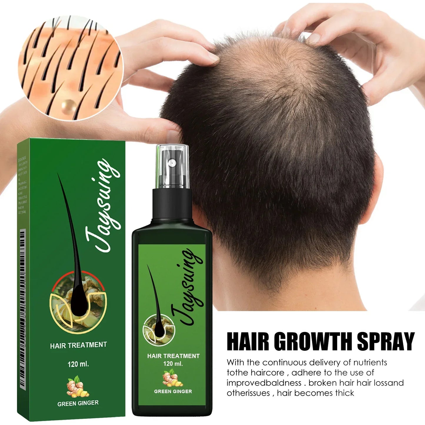 Ginger Hair Growth Serum Spray – Scalp Treatment & Hair Loss Peaceful Pleasures Health and Wellness