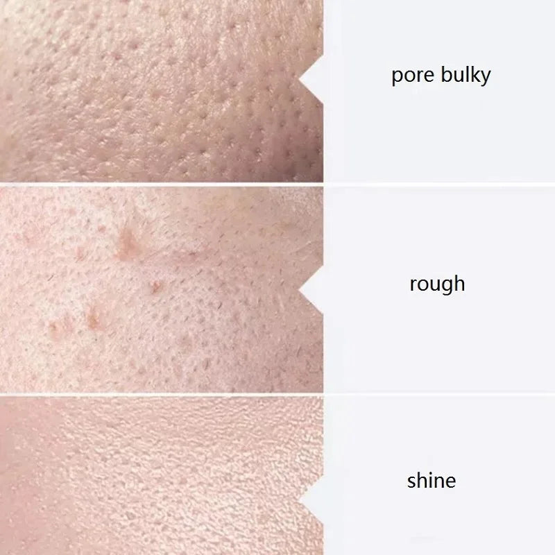 Aqua Peel Facial Serum Kit AS1 SA2 AO3 | 400ml Set of 3