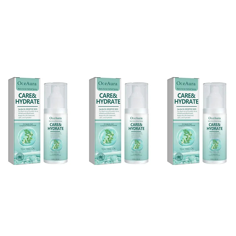 OceAura Herbal Acne Spray – Back, Shoulder & Pore Treatment