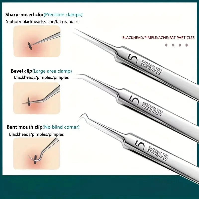 8 PCS Stainless Steel Acne Clip, Cell Clip, Blackhead Clip, Acne Needle, Beauty Salon Acne Needle, Acne Needle Tool Peaceful Pleasures Health and Wellness