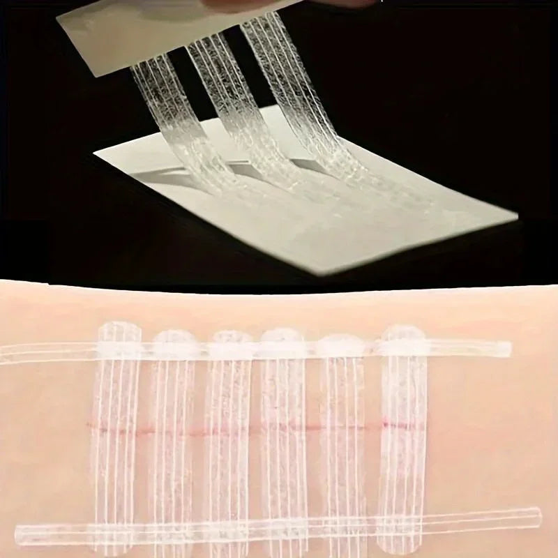 5 Strips Wound Skin Closure Strips Postpartum Wound Repair Cosmetic Surgery Strip Adhesive Medical Suture Free Surgical Tape Peaceful Pleasures Health and Wellness