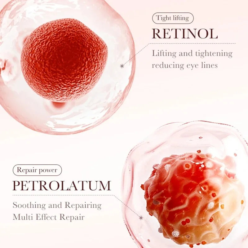 YOUNGCOME Retinol Eye Cream for Dark Circles & Wrinkles Retinol Eye Cream Peaceful Pleasures Health and Wellness