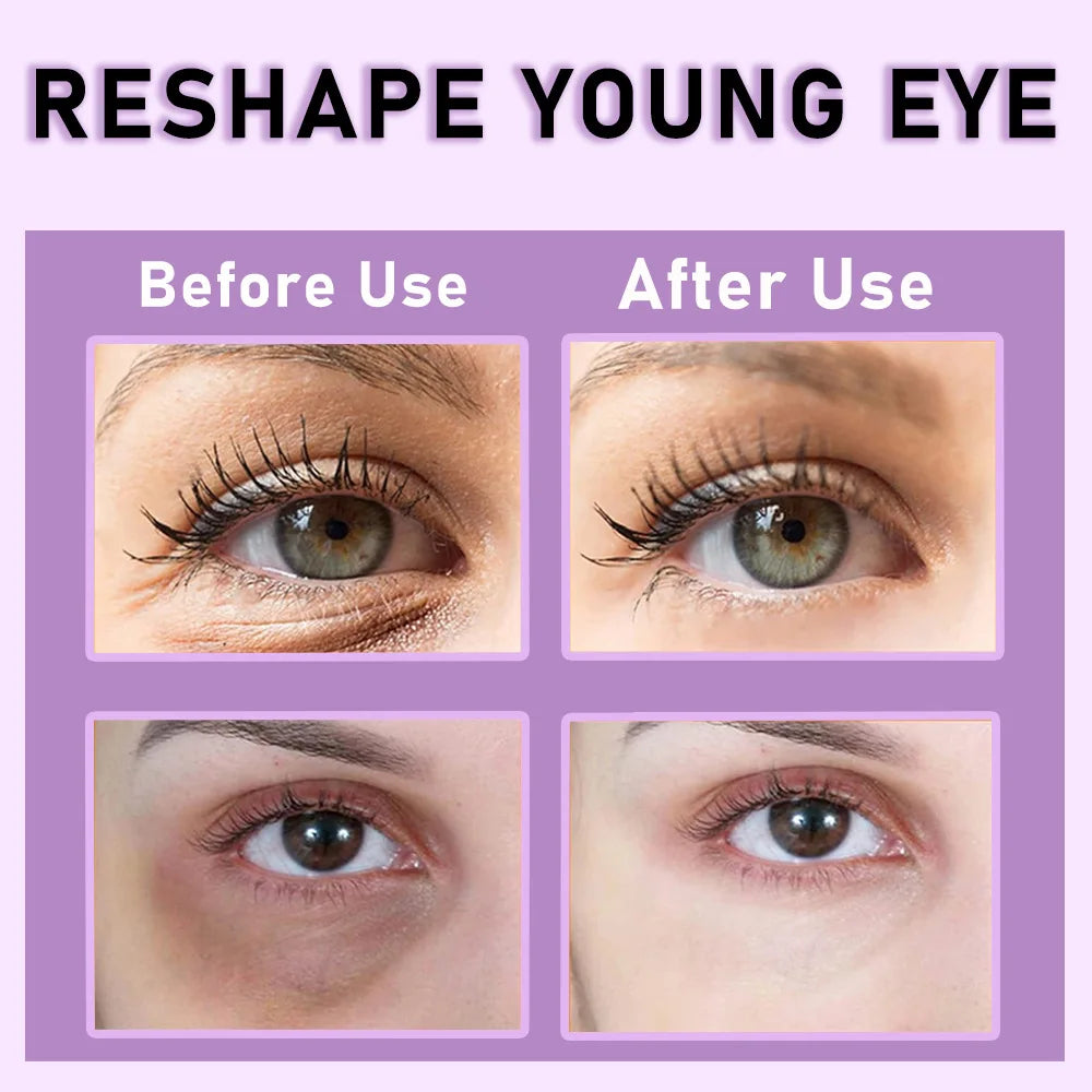 Retinol Firming Eye Cream | Collagen & Niacinamide, 20ml