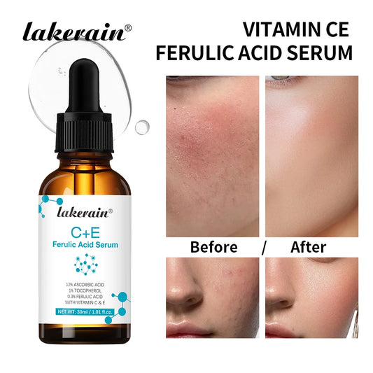 Vitamin C Face Serum Reduce Dark Spots Acne Scars Provides Firming Diminishes Fine Lines Facial Essence Korean Skin Care Product Peaceful Pleasures Health and Wellness