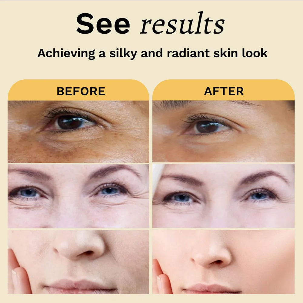 2pcs Tumeric Dark Spots Toner Spots Eraser Corrector Turmeric Fade Blemishes Dark Spot Remover Acne Remover Toner for Dark Skin Peaceful Pleasures Health and Wellness