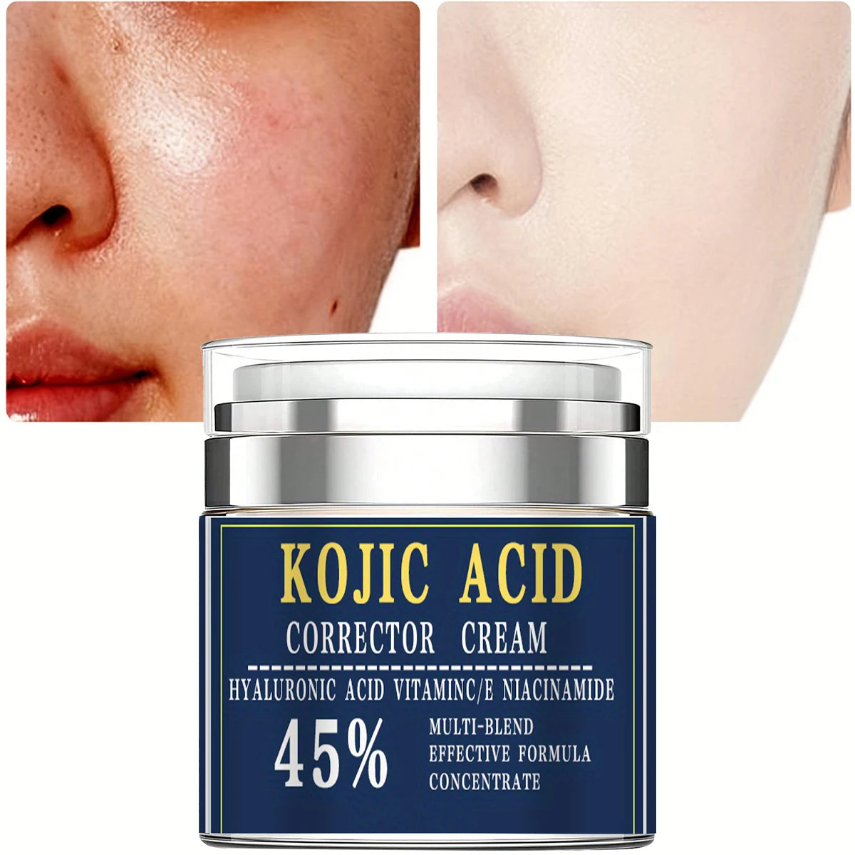 Glycolic Acid Cream with 15% Lifting & Firming Face Cream Hydrates & Moisturizes Improve Dark Spot Sagging Skin Fades Fine Lines Peaceful Pleasures Health and Wellness 50G