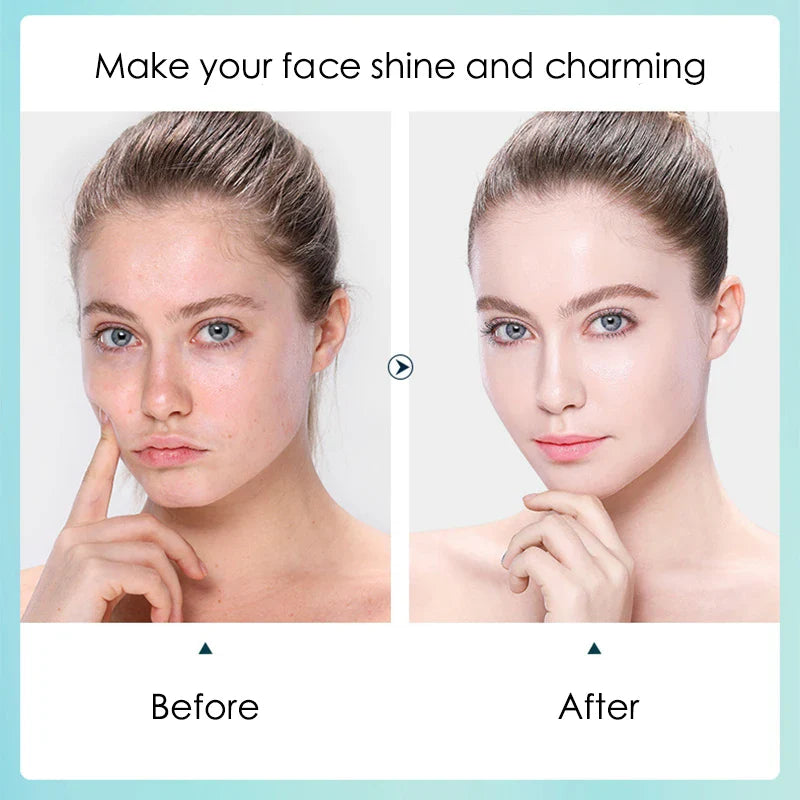 BIOAOUA Hyaluronic Acid Sheet Masks 10-Pack – Hydrate & Pores