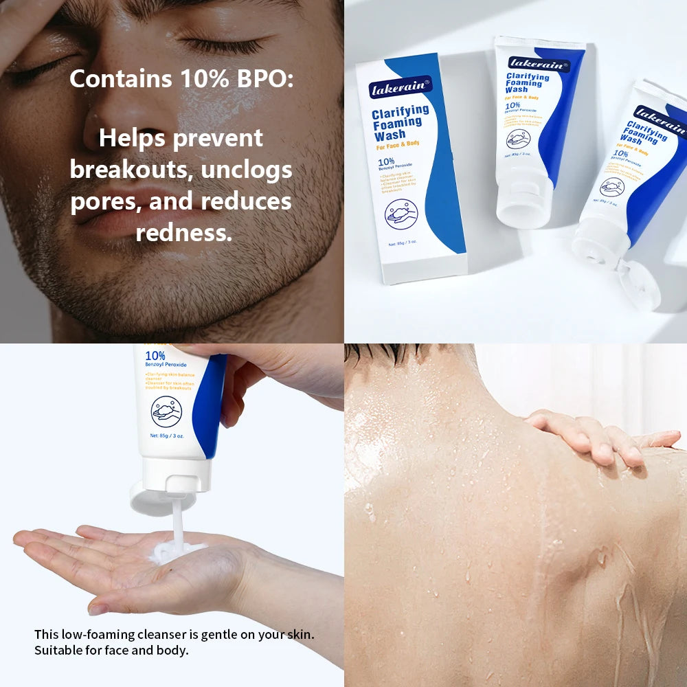Acne Foaming Wash Benzoyl Peroxide 10% Maximum Antimicrobia Moisturizers reduces redness For Face & Body Skin Care Face Wash Peaceful Pleasures Health and Wellness