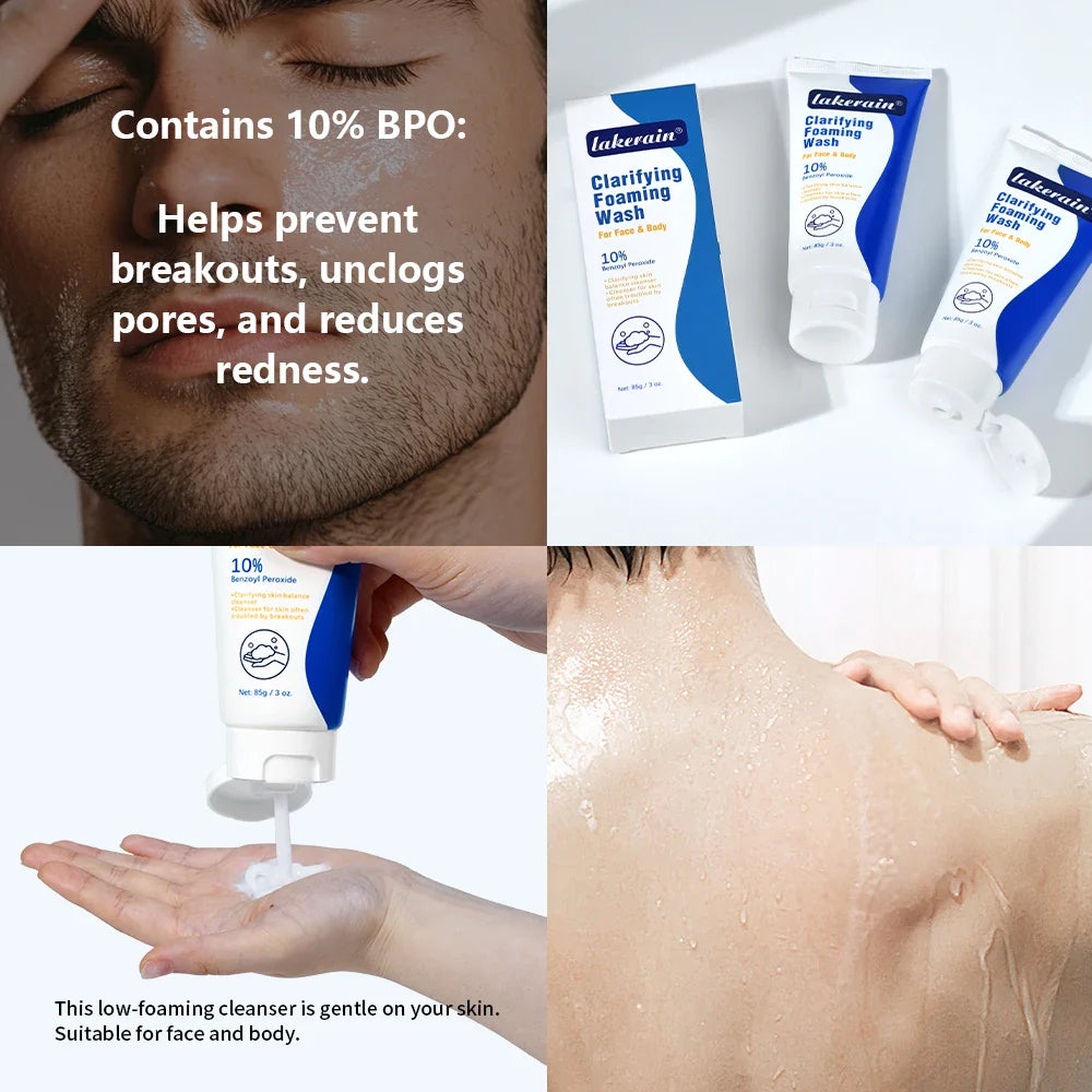 10% Benzoyl Peroxide Foaming Face & Body Wash | Oil Control