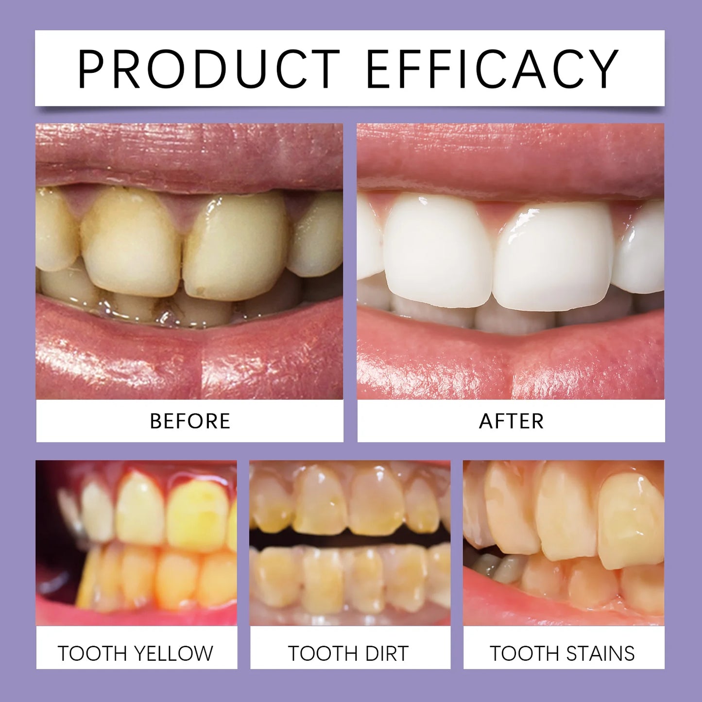 Teeth Brightening Strips 5 Pairs – Daily Smile Care