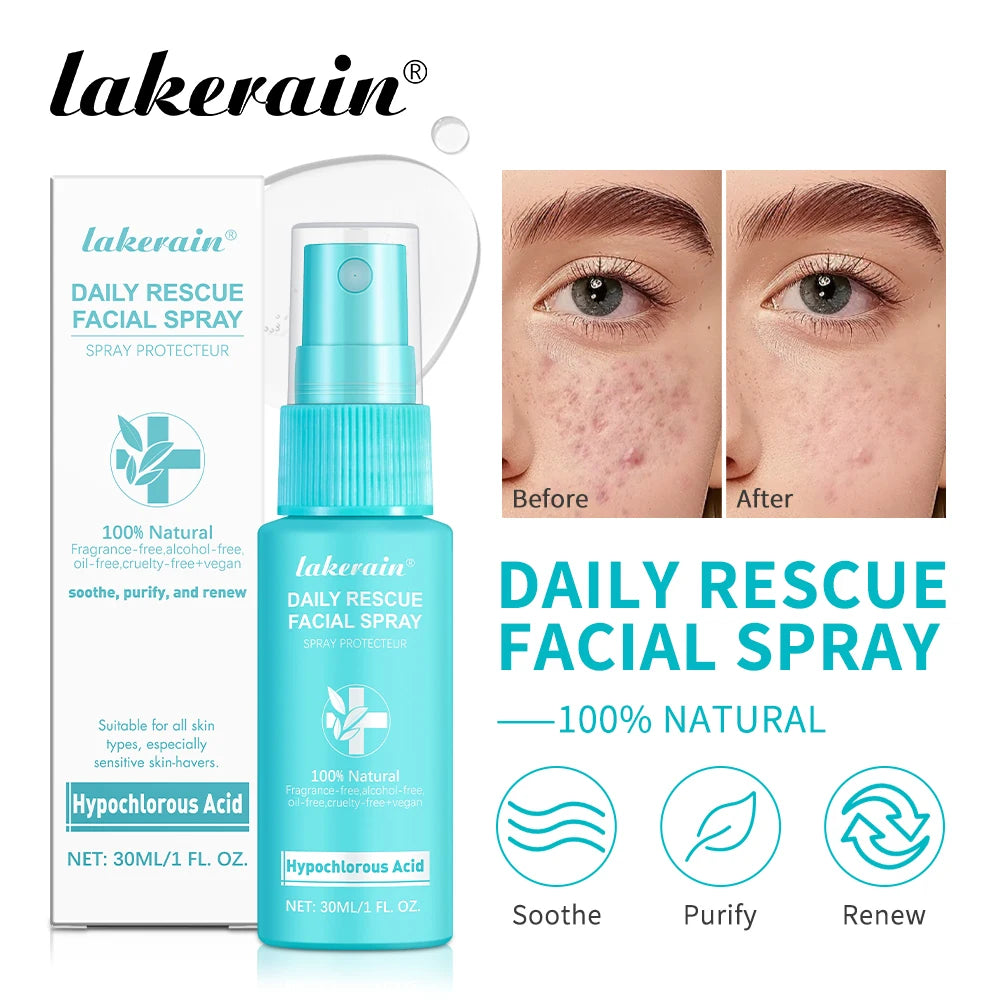 Calming Rescue Facial Spray For Sensitive Skin Hypochlorous Acid Spray Helps Reduce Redness Breakouts Soothing Balancing Spray Peaceful Pleasures Health and Wellness
