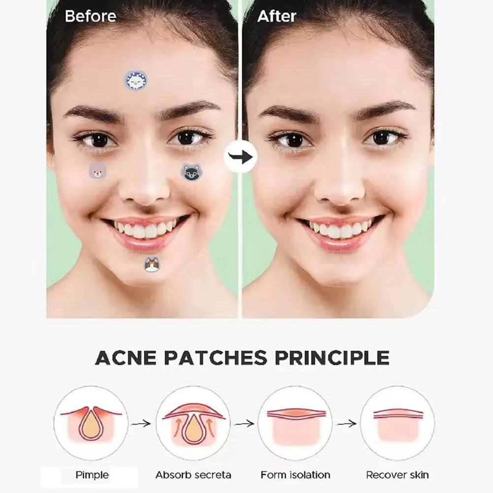 Cute Cat Cartoon Acne Patches – Hydrocolloid Blemish Dots 220pc