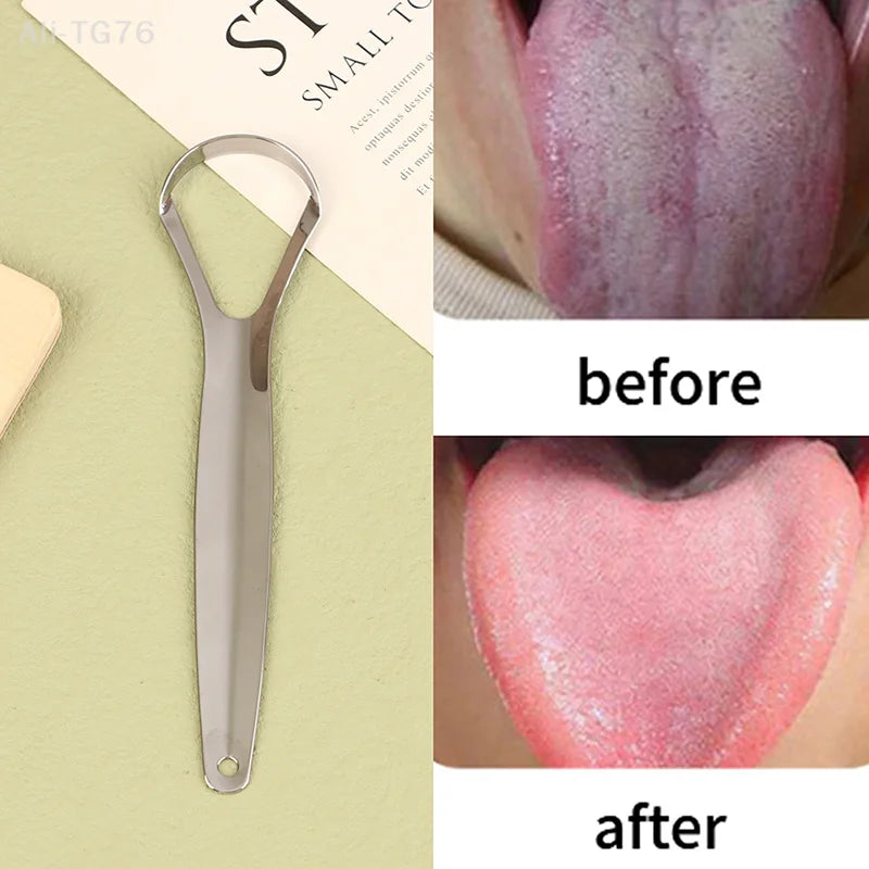 Stainless Steel Tongue Scraper | Fresh Breath Dental Tool