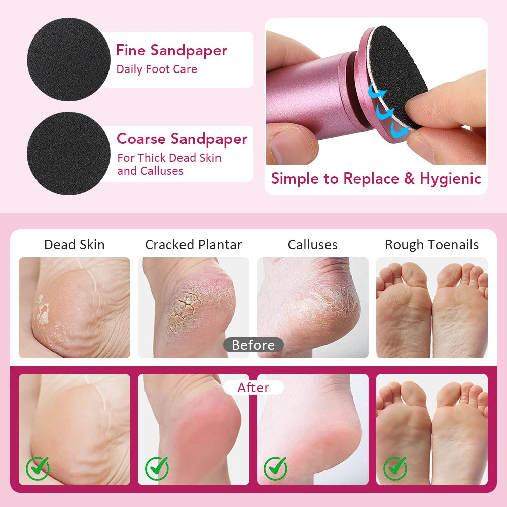 Electric Foot Callus Remover Foot File for Cracked Heels Dead Skin Pedicure Tool with 20PCS Sandpaper Discs Massage Foot Grinder Peaceful Pleasures Health and Wellness