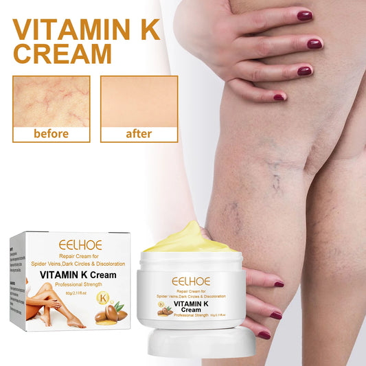 Vitamin K Cream for Varicose Veins, Spider Veins & Leg Relief
