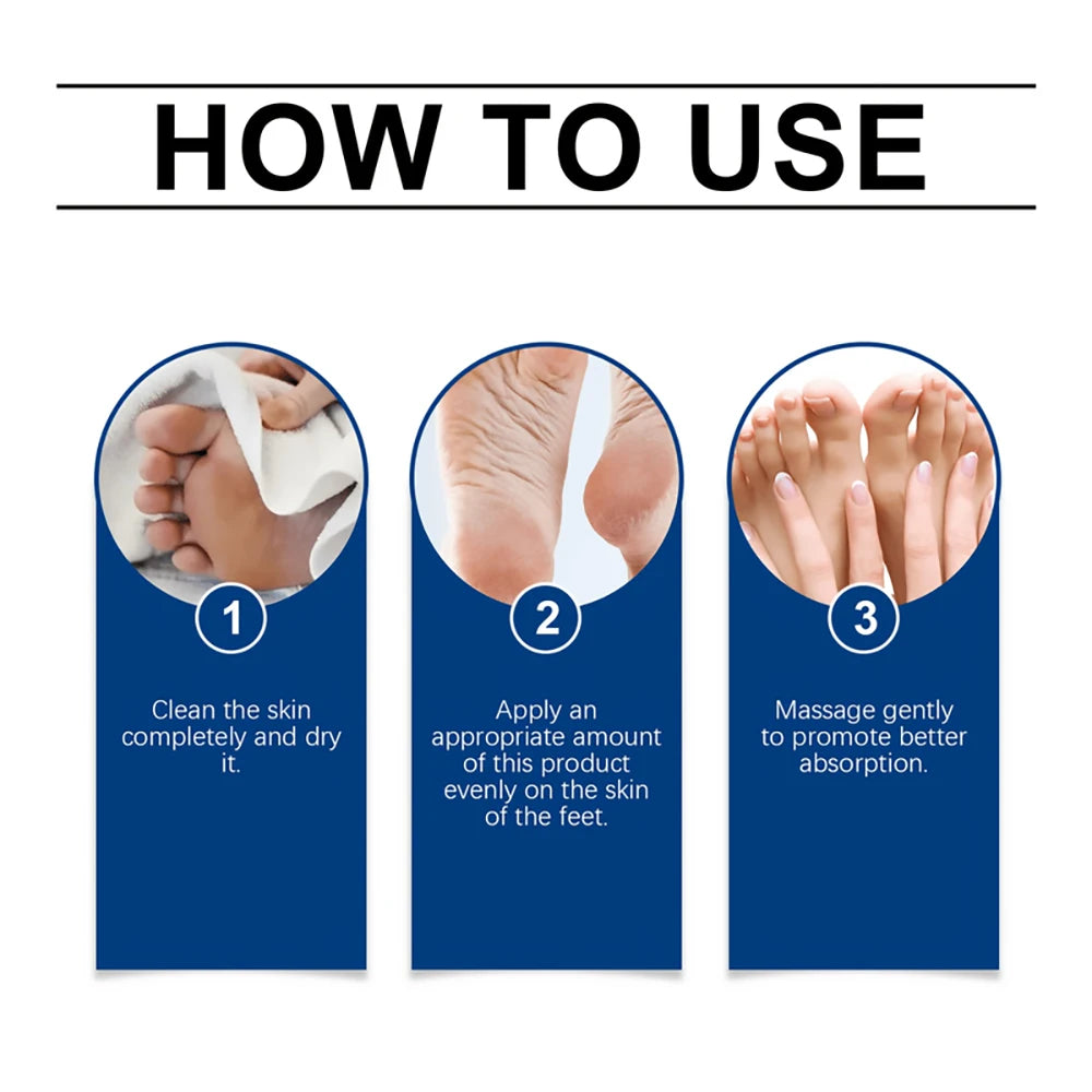 SUYARUN 60% Urea Foot Cream for Cracked Heels & Dry Skin - Intensive Moisturizing Treatment, Callus Remover, Diabetic Foot Care. Peaceful Pleasures Health and Wellness