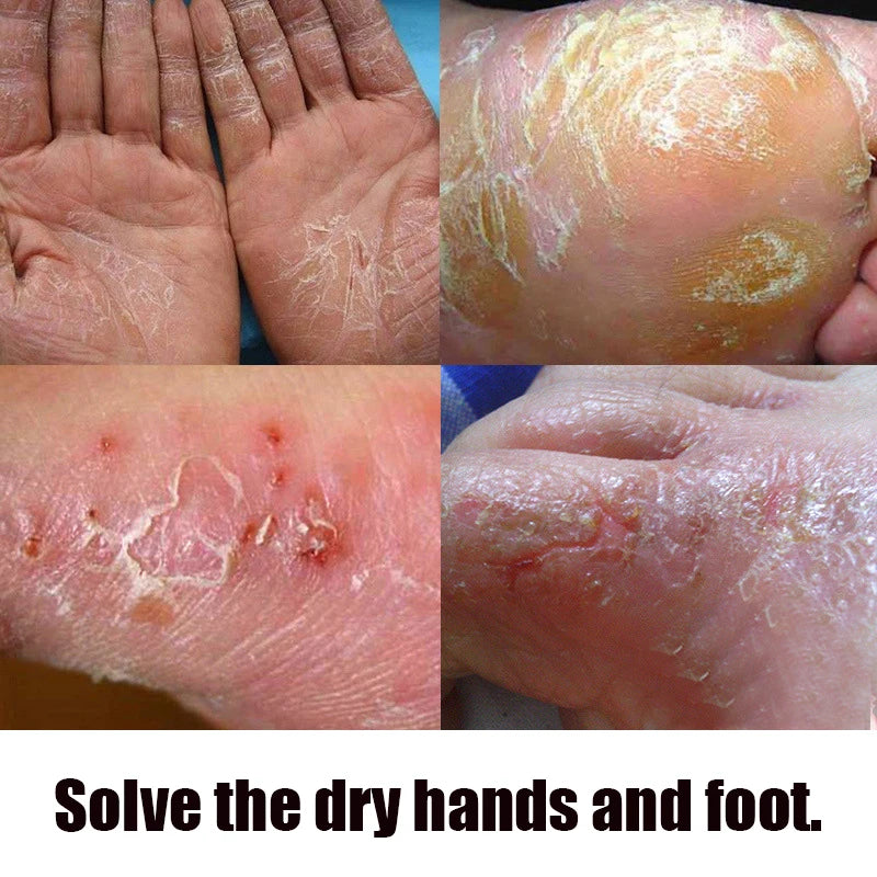 45g*3 Traditional Chinese Clam Oil Hand&Foot Cream Anti Drying Crack Heel Cracked Repair Cream Removal Dead Skin Hand Feet Care Peaceful Pleasures Health and Wellness