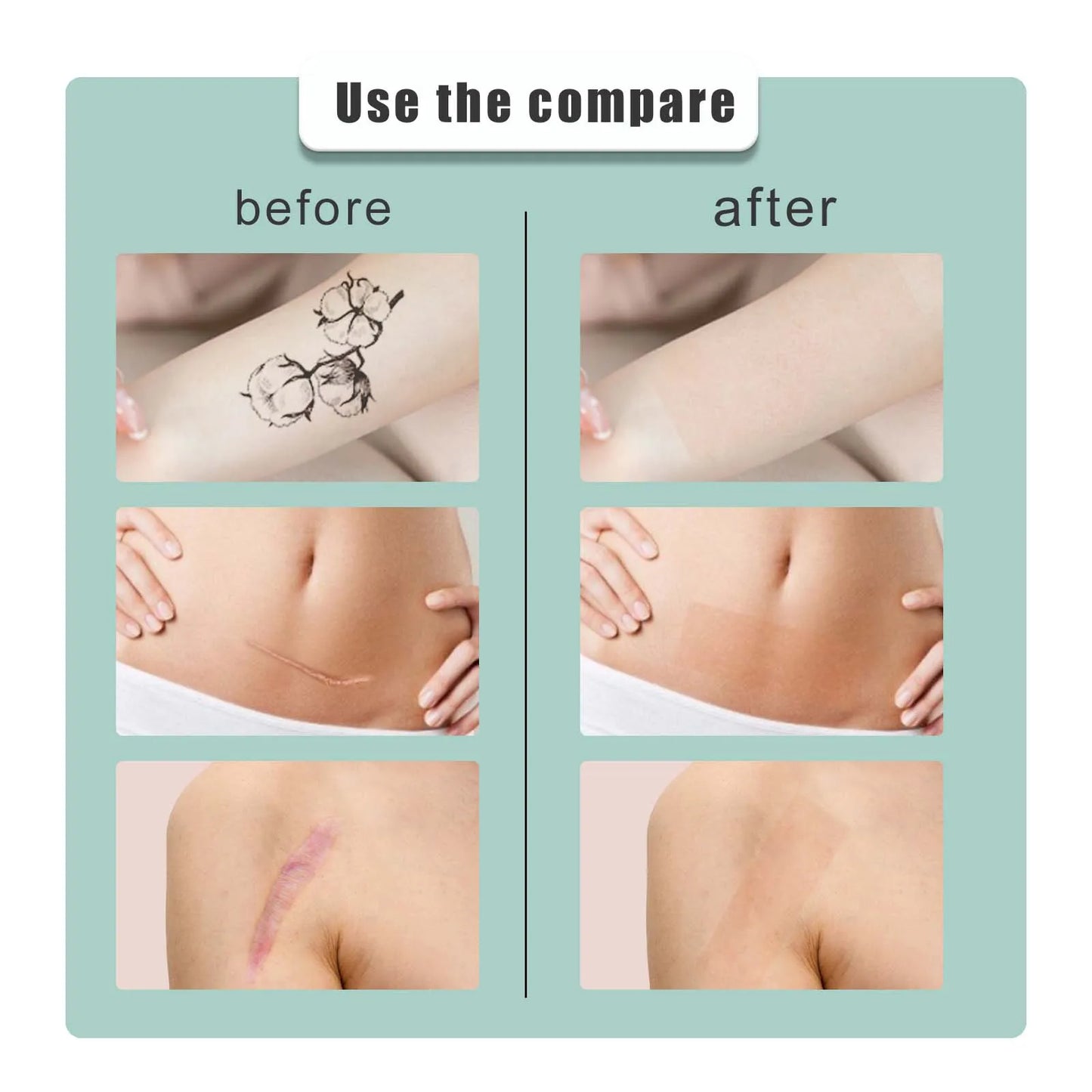 Waterproof Tattoo Cover Up Patches | Breathable Skin Concealer