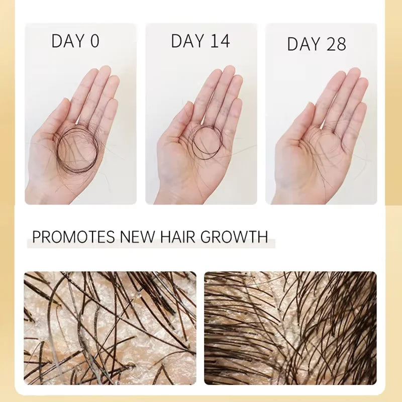 Biotin Prevent Hair Loss Shampoo And Conditioner Growth Oil Treatment For Hair Fast Regrowth Care Beard Hair Beauty Health Care Peaceful Pleasures Health and Wellness