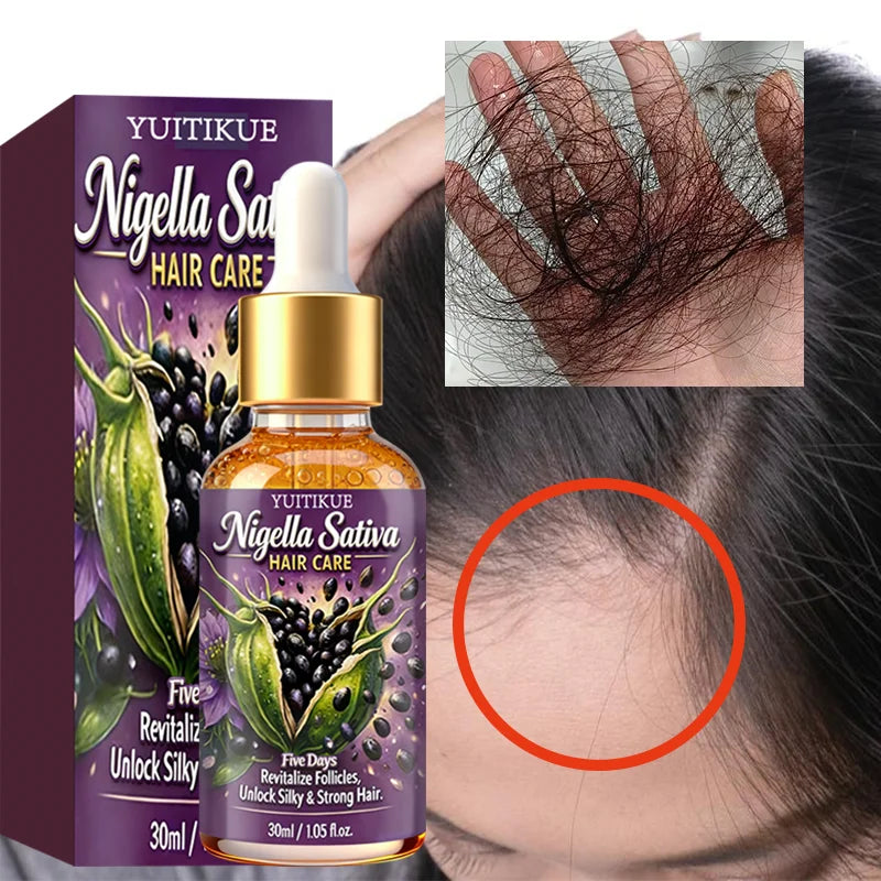 YUITIKUE Nigella Sativa Hair Care Oil | 5 Days Formula To Revitalize Follicles | For Silky, Strong & Healthy Hair 30ml Peaceful Pleasures Health and Wellness