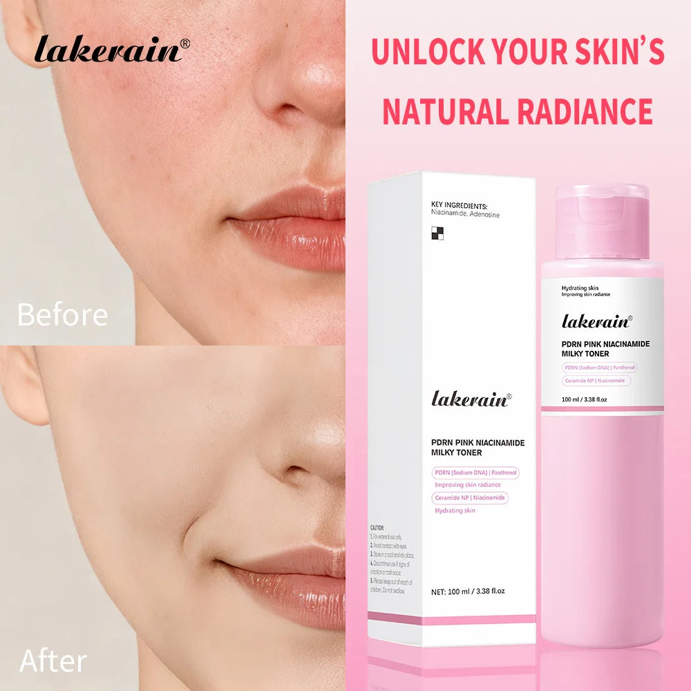 Pink Niacinamide Milky Toner Long-lasting Hydration Even Skin Tone Quickly Absorbed Achieve Dewy Glass Skin Daily Milky Toner Peaceful Pleasures Health and Wellness