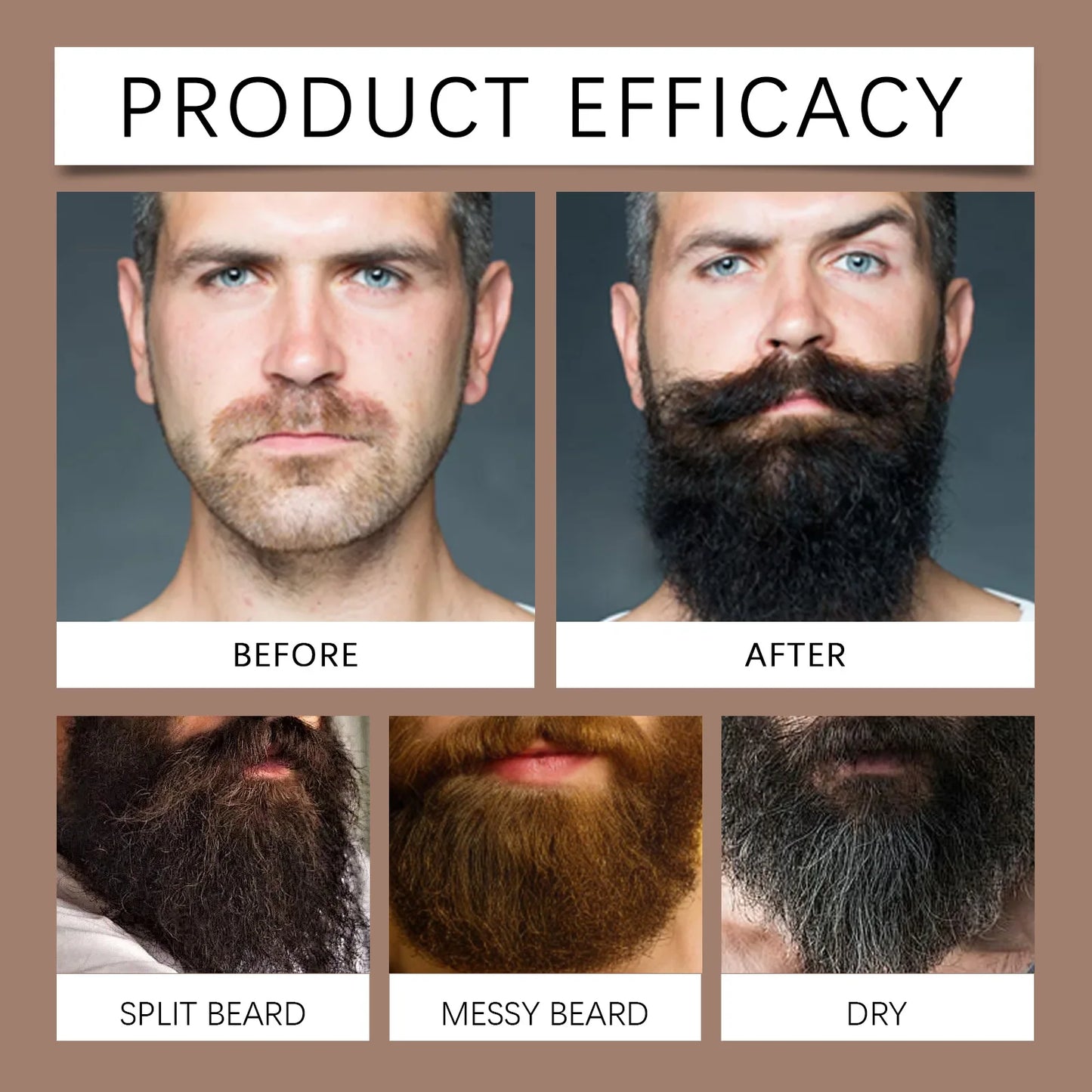East Moon Beard Care Oil – Deep Moisture & Growth, 30ml