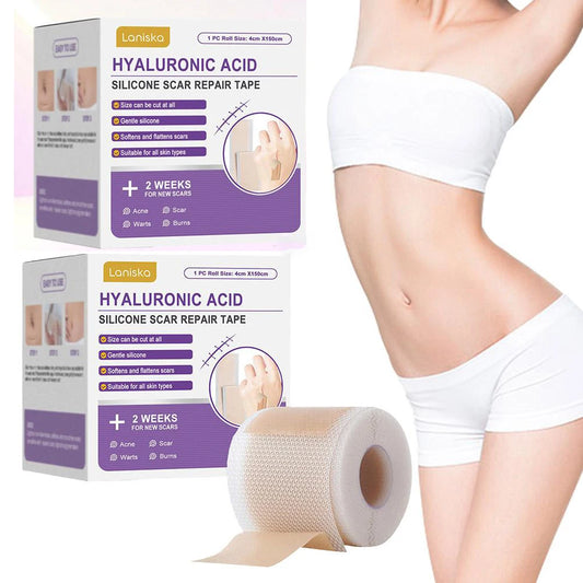 Silicone Scar Tape Roll – Self-Adhesive Scar Sheets for Surgical & Burn Scars Peaceful Pleasures Health and Wellness