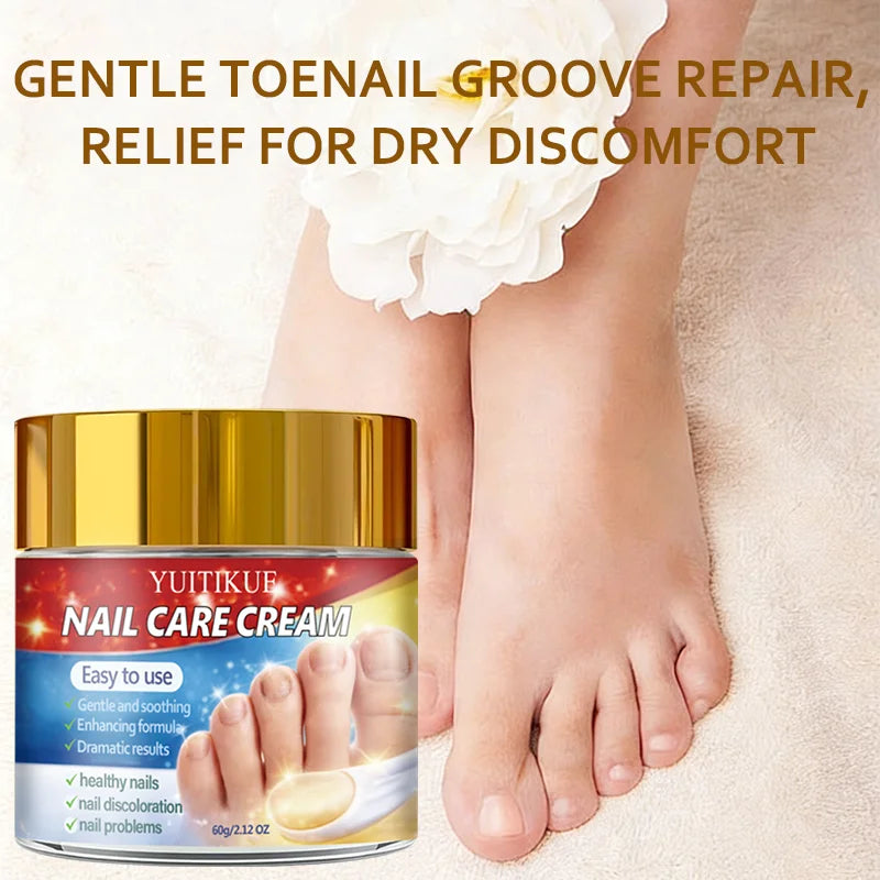 Yuitikue Nail Care Cream, 60g Gentle Nail Repair Cream for Nail Discoloration & Nail Problems, Promoting Healthy Nails Peaceful Pleasures Health and Wellness