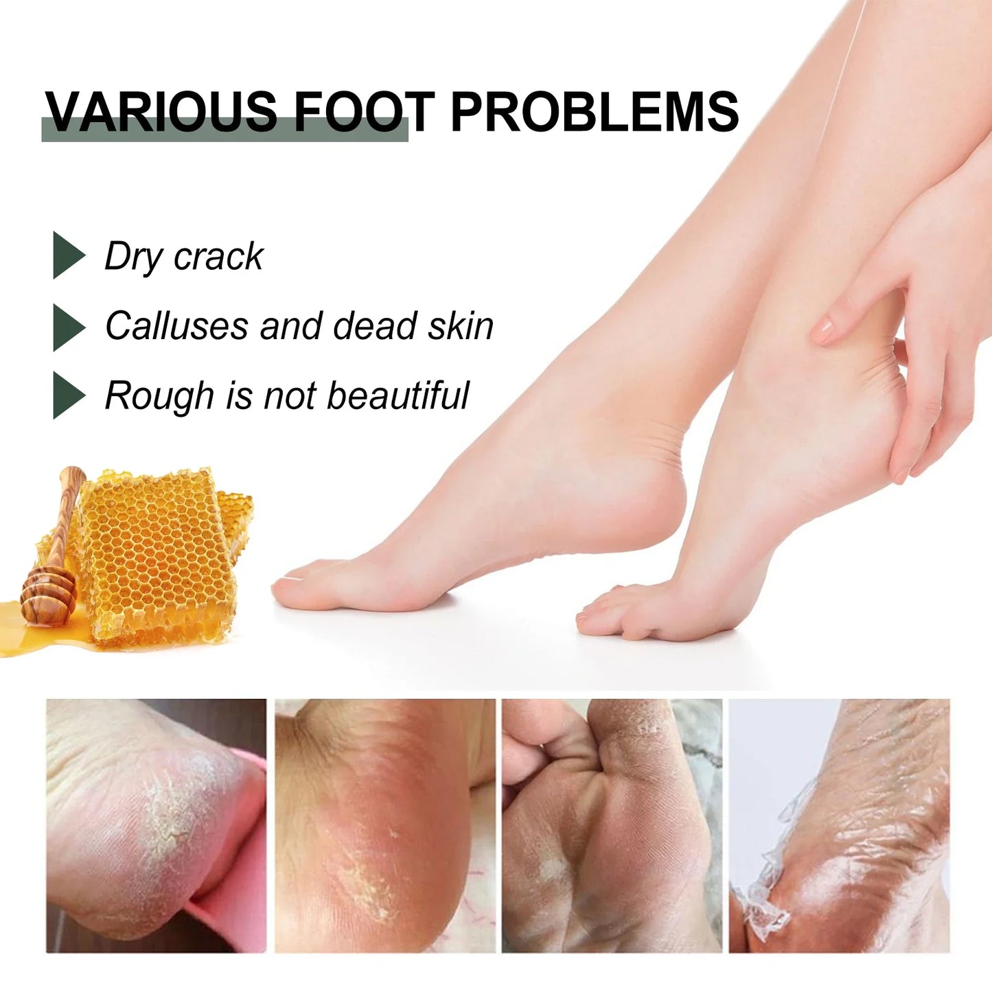 WOODSLEEP Cracked Heel & Hand Repair Cream – Deep Moisturizer