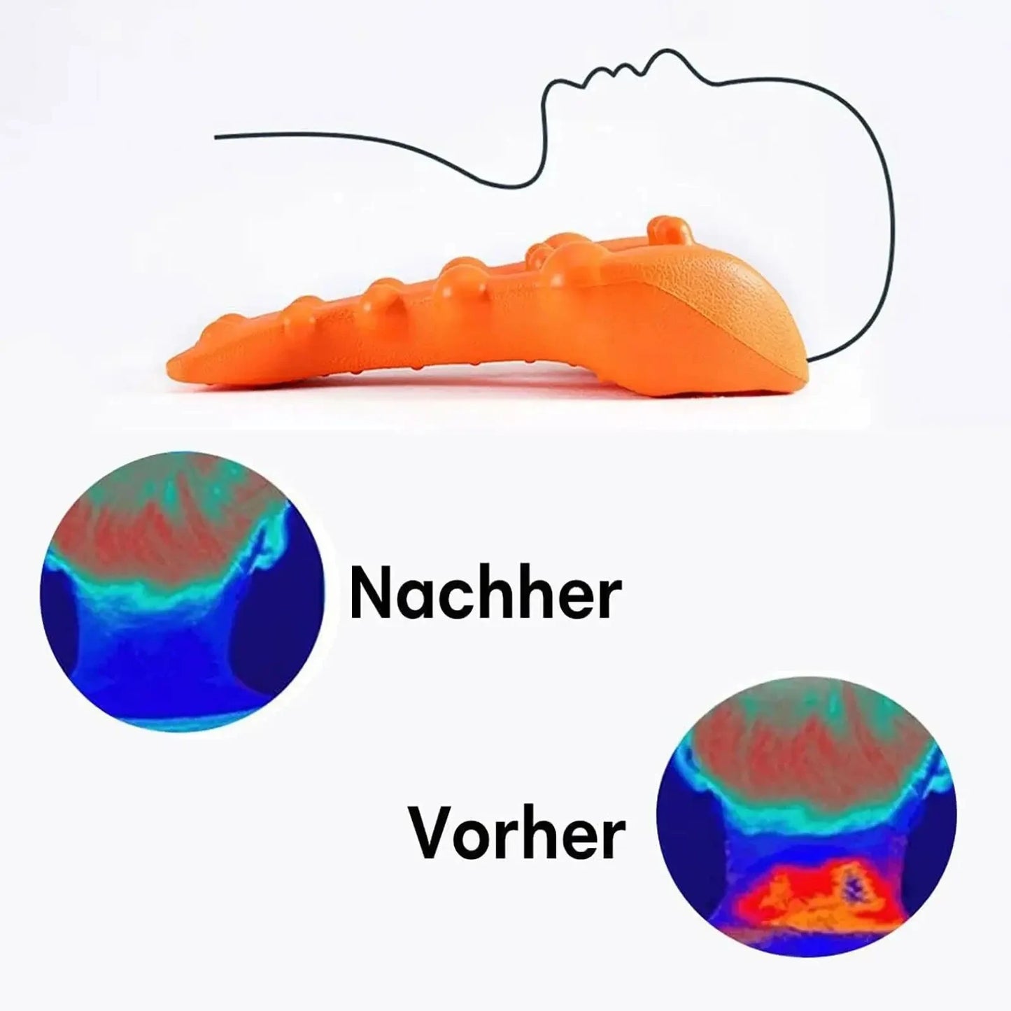 Neck Stretcher Acupressure Massager – Shoulder Support Tool