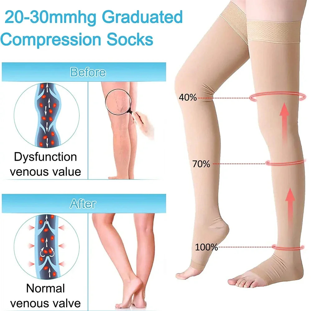 1Pair Open Toe Thigh High Compression Stockings with Silicone Band for Women Men,20-30 mmHg Graduated Support for Varicose Veins Peaceful Pleasures Health and Wellness