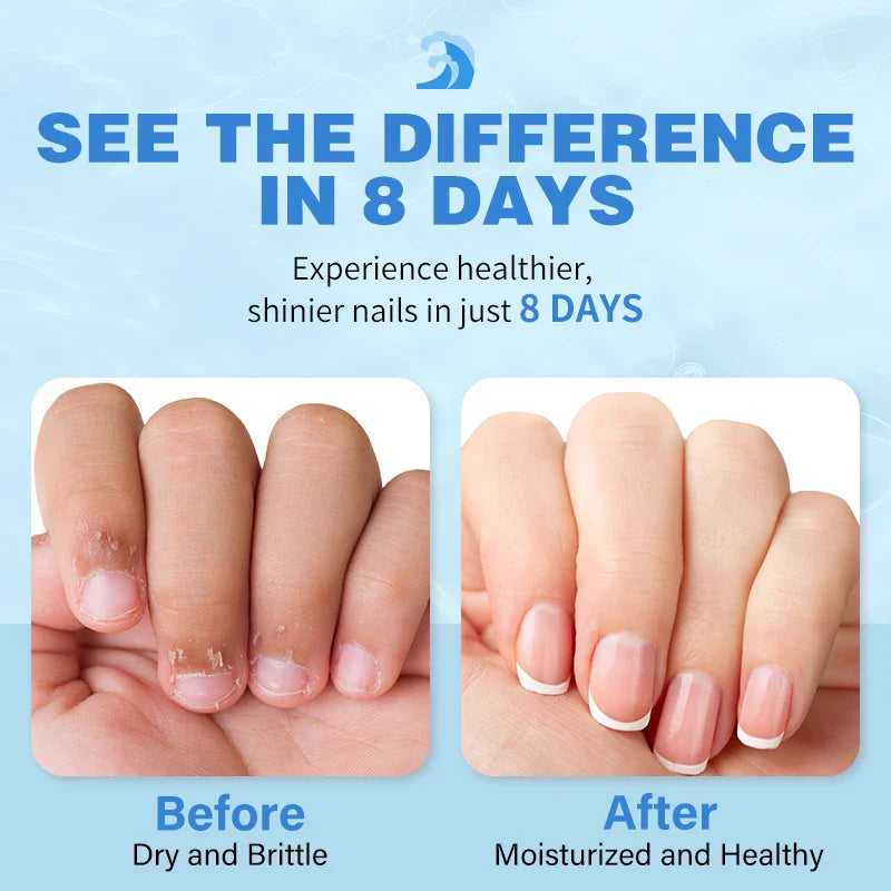 Ocean Breeze Cuticle Oil – Repairs & Strengthens Nails Overnight