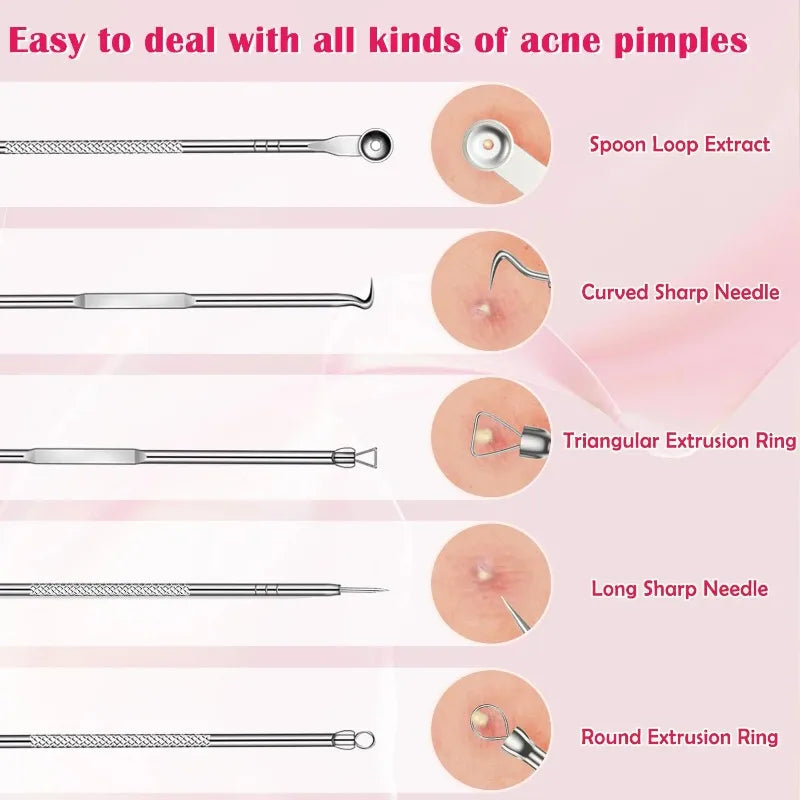 4-Pack Stainless Steel Blackhead & Comedone Extractor Kit