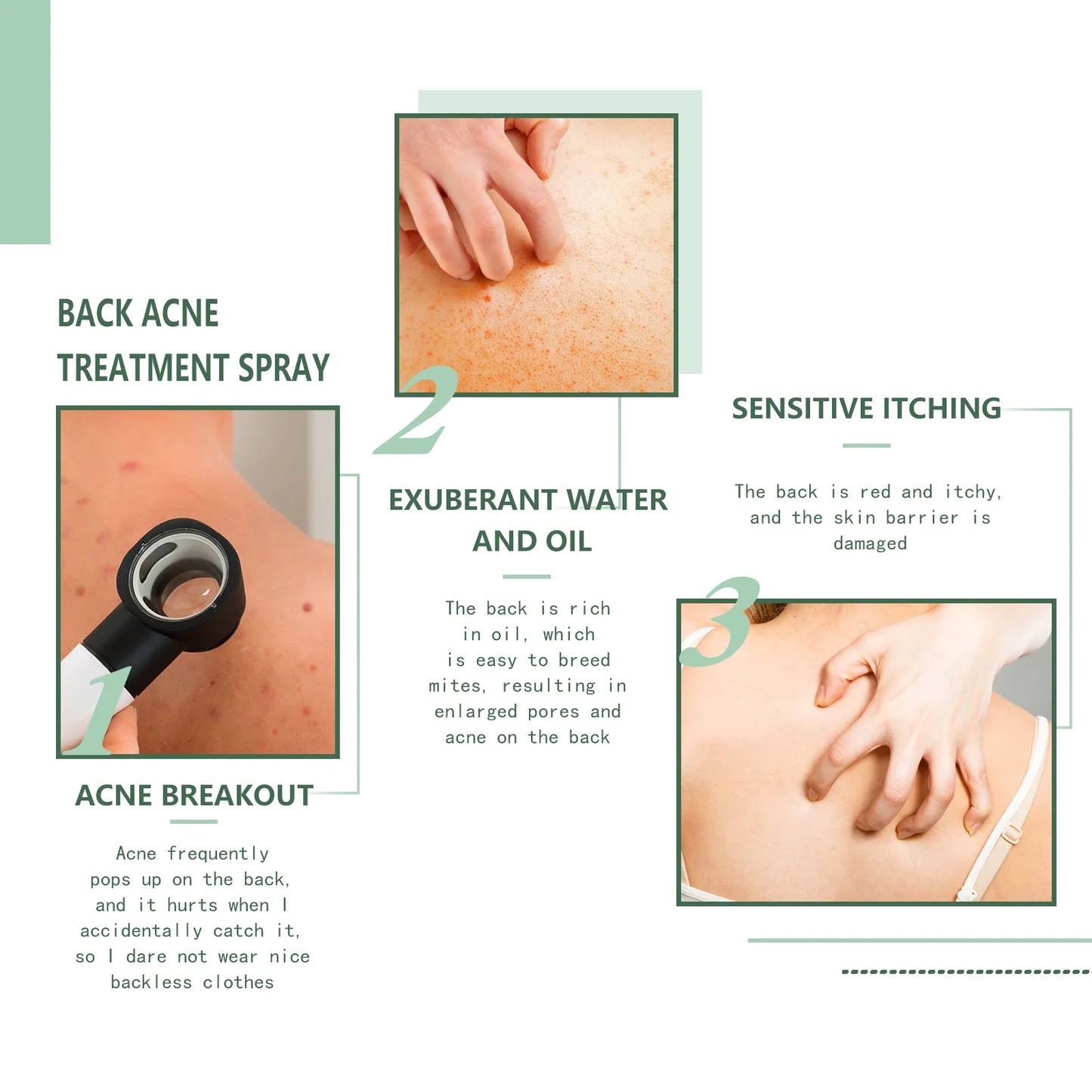 Eelhoe Back & Body Acne Repair Spray 120ml | Clarifying Serum