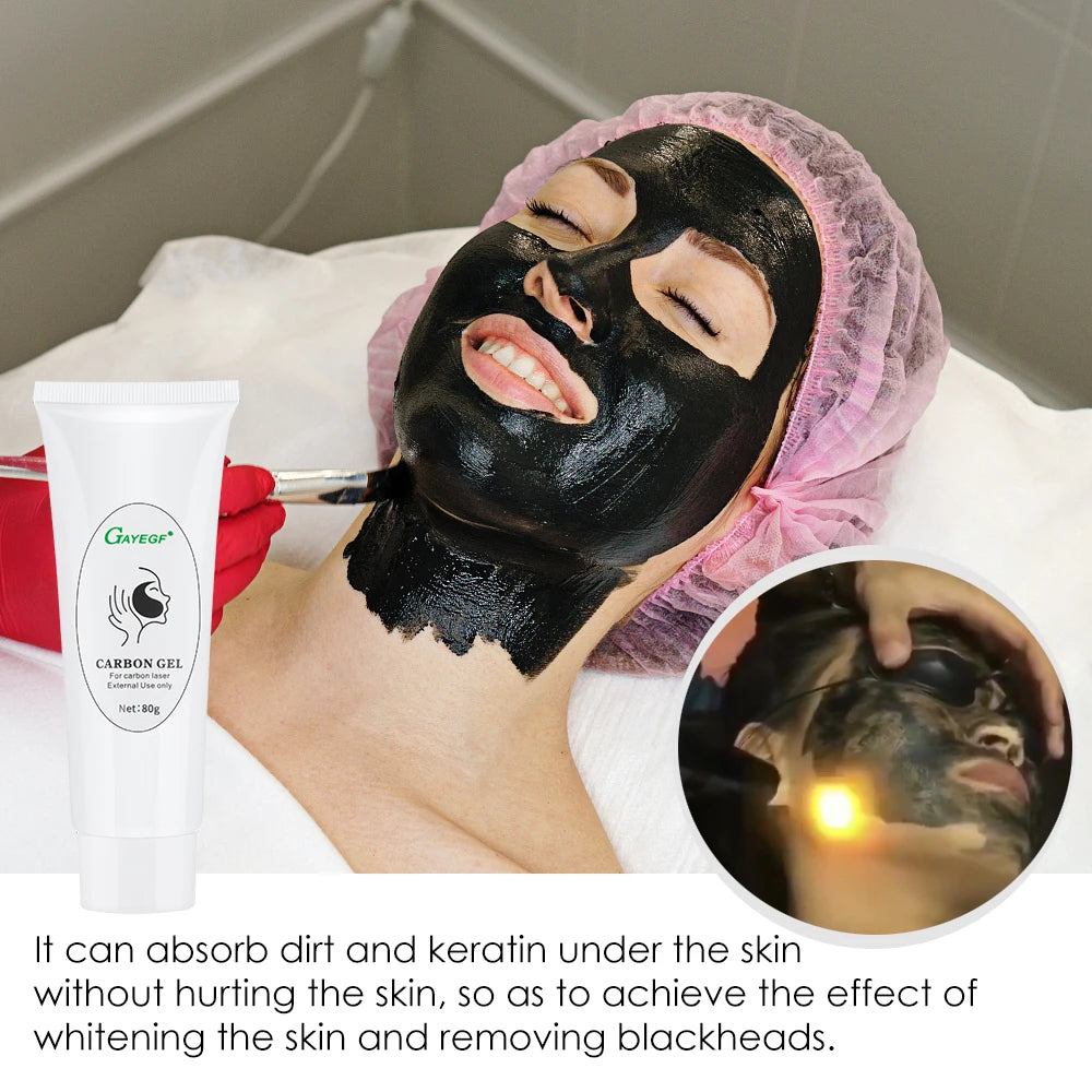 Active Carbon Gel for Laser Skin Rejuvenation, Removing Blackheads, Shrink Pores, Absorb Dirt, Face Cream Used with Nano Light Peaceful Pleasures Health and Wellness