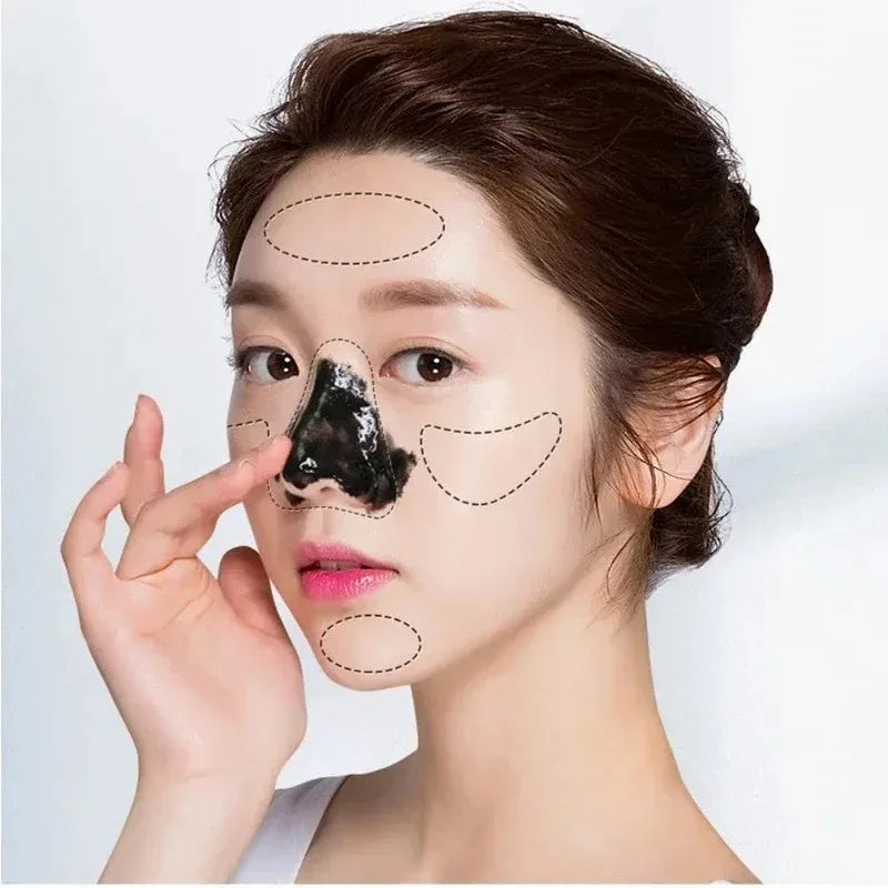 LANBENA Blackhead Remover Peel Mask – Deep Pore Cleansing