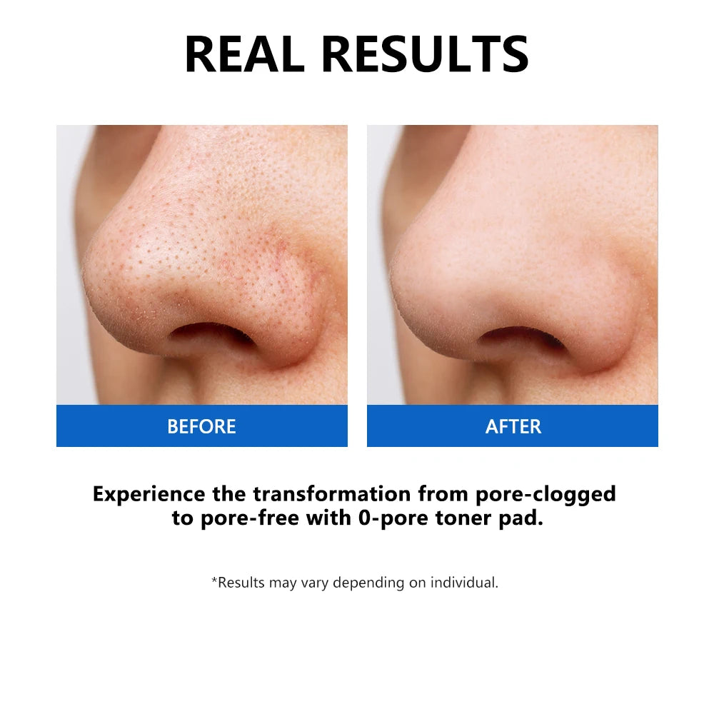 Zero Pore Toner Pads Control Oil Reduce Sebum Exfoliate Deep Clean Refines Pores Antioxidant Skincare Treatment skincare korean Peaceful Pleasures Health and Wellness