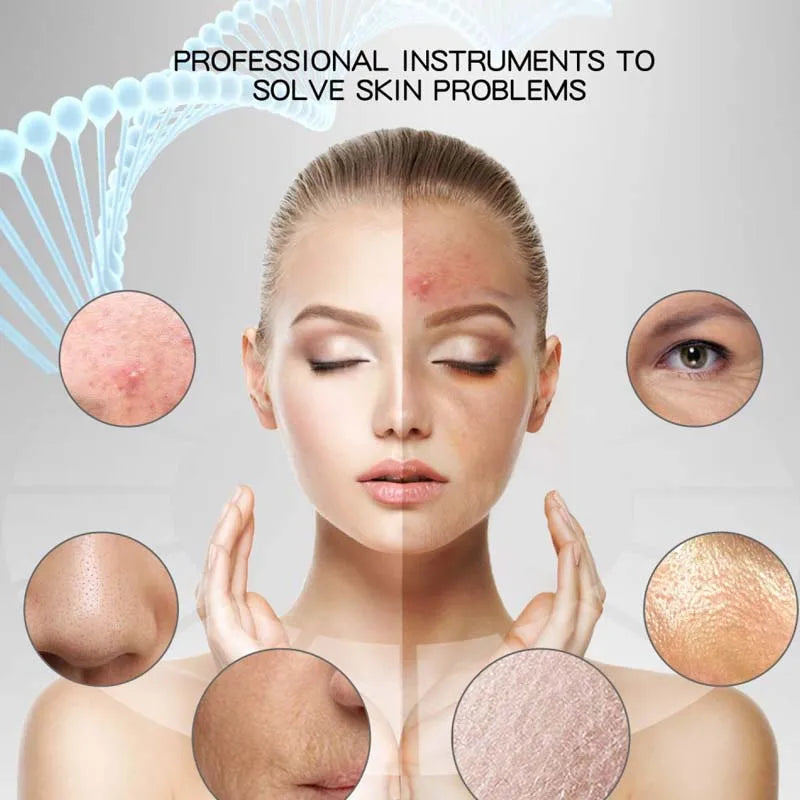 Professional Ultrasonic Facial Peel Cleaner High Beauty Product Electric Sonic Skin Scrubber Spatula for Nose Lips Exfoliating Peaceful Pleasures Health and Wellness