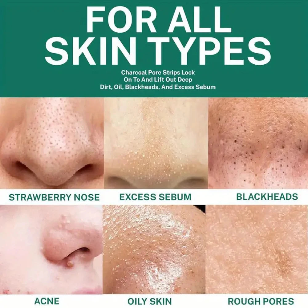 Unisex Deep Cleansing Nose Strips for Acne & Blackhead Removal Shrink Pore Nose Black Head Stickers Skin Care Patch Peaceful Pleasures Health and Wellness
