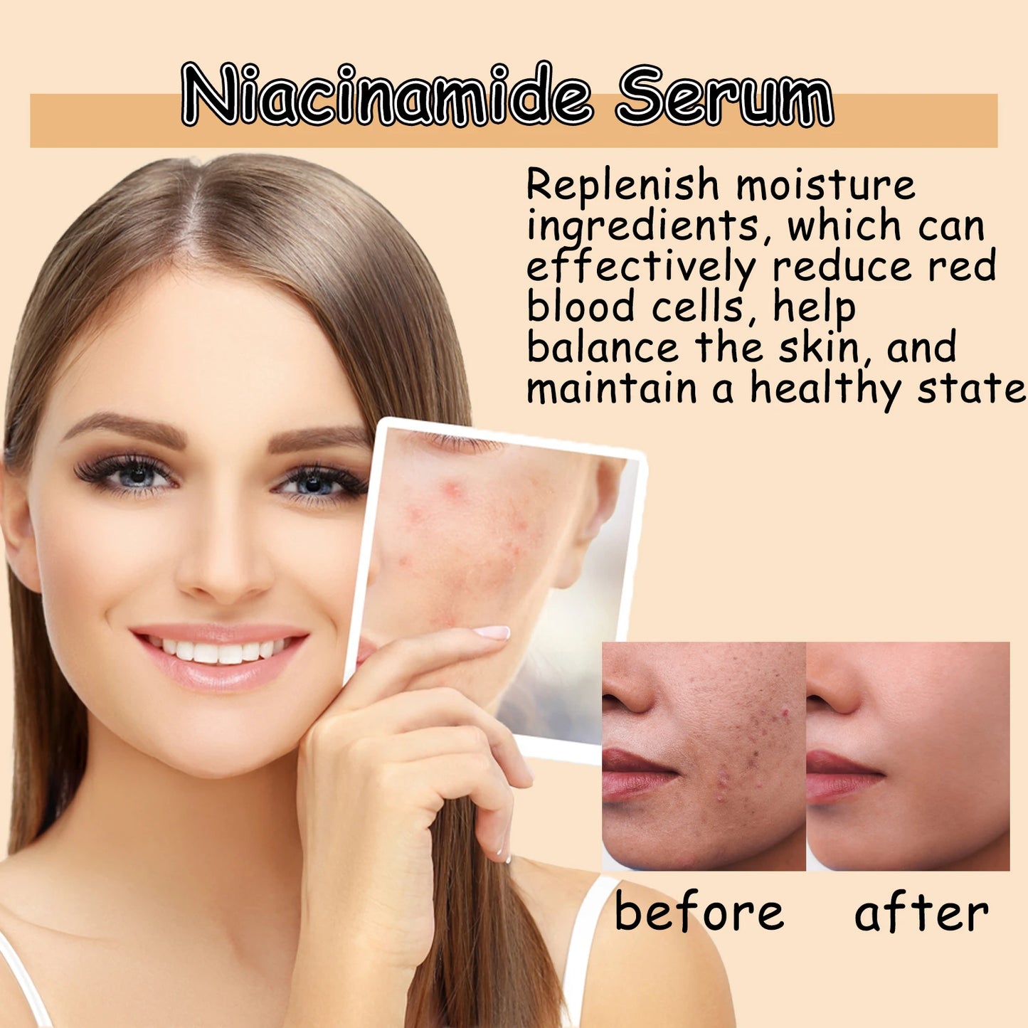 Niacinamide Face Serum – Brighten, Hydrate & Shrink Pores