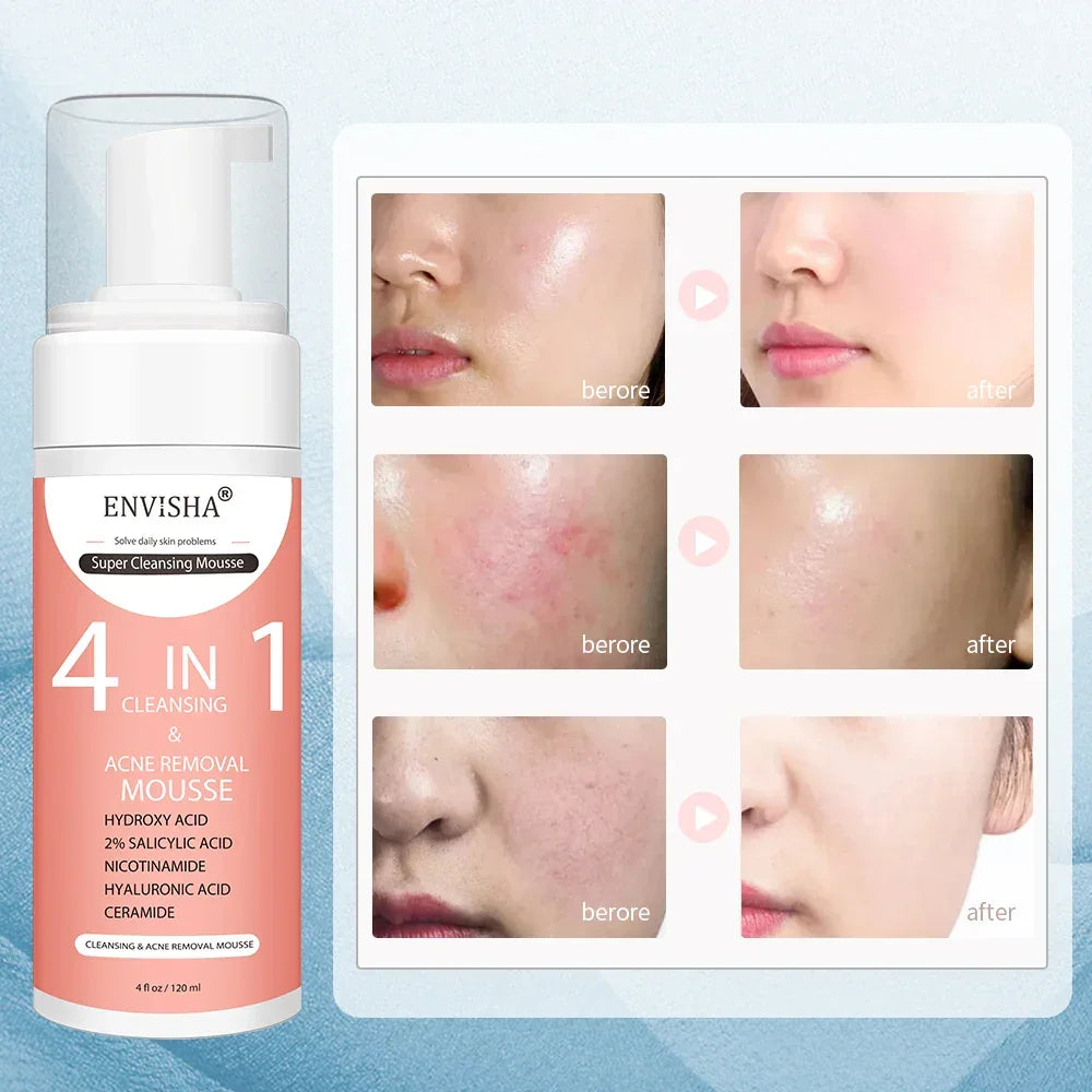 ENVISHA Exfoliating Mousse Peeling Gel – Deep Cleanse & Pore Refining 120ml Face Cleanser Peaceful Pleasures Health and Wellness