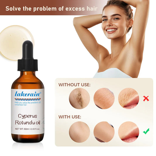 Cyperus Rotundus Hair Growth Inhibitor Oil 60ml | ibcccndc Hair Growth Inhibitor Oil Oasis Select