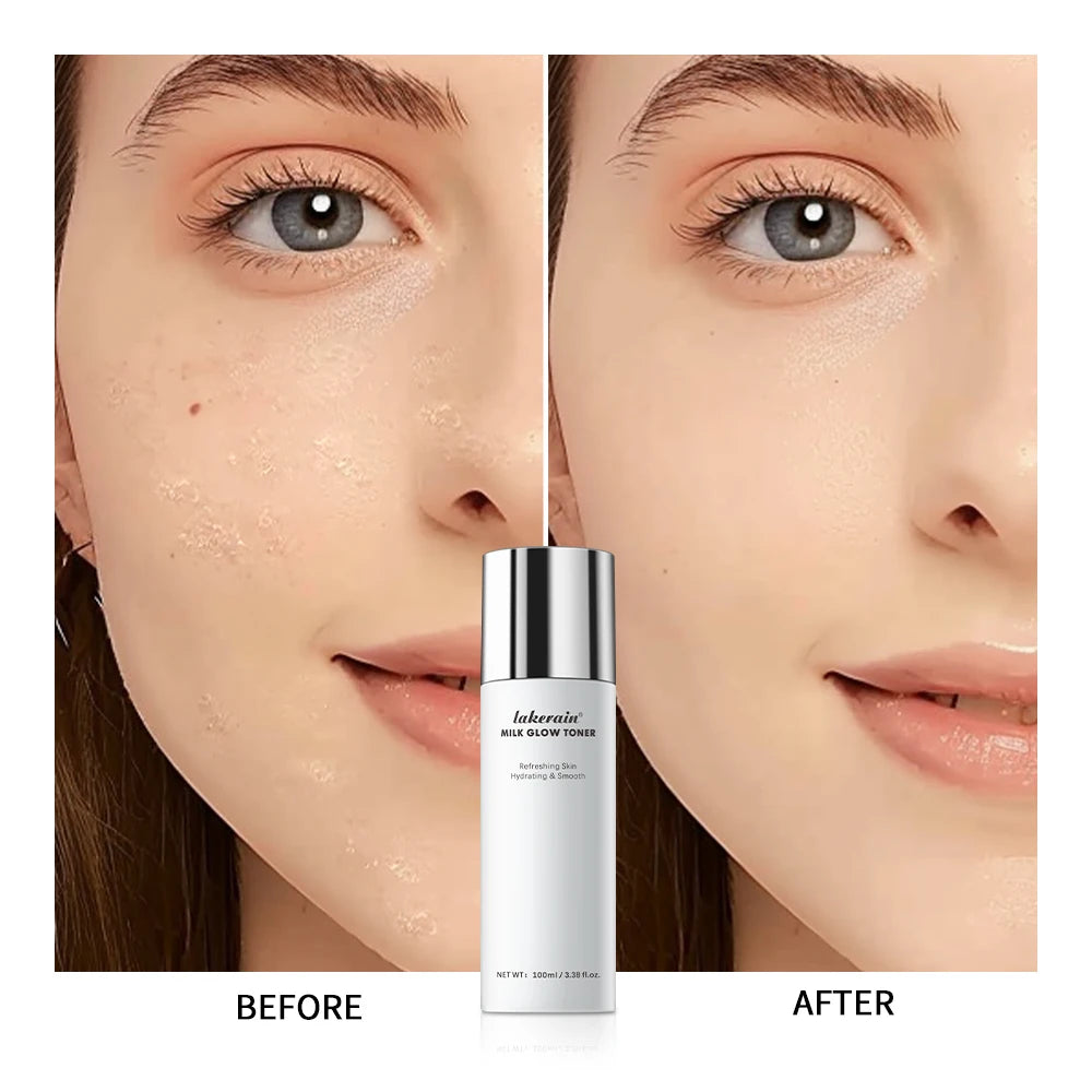 Milk Soothing Toner Moisturizing Water For Face Facial Toner Natural Houttuynia Cordata Extract Refresh Claming Skin Peaceful Pleasures Health and Wellness