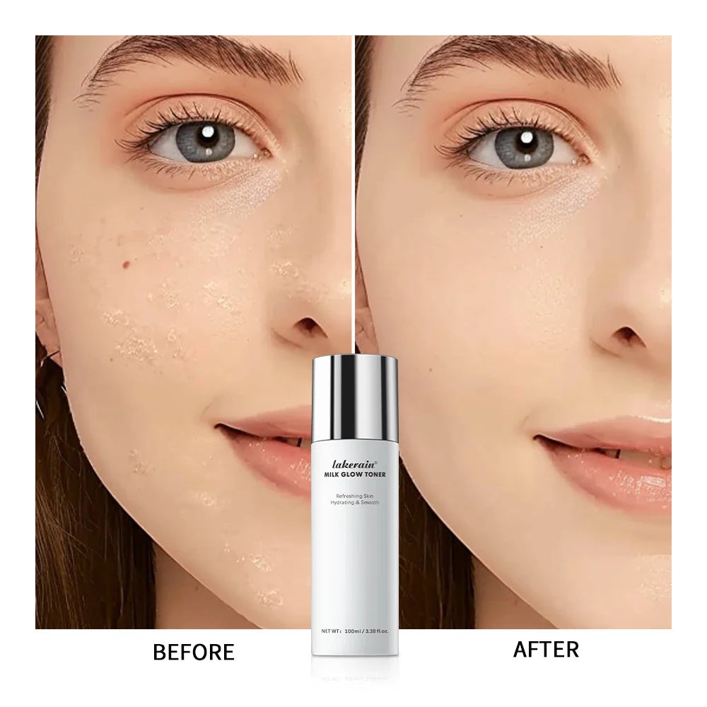 Milk Soothing Facial Toner – Niacinamide & Houttuynia Extract